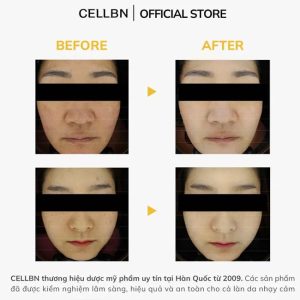 Serum Trắng Da Mờ Thâm Nám Glutathione 20.000ppm CELLBN - Ảnh 4